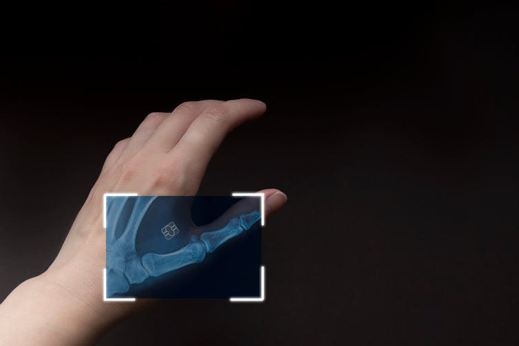 Technology firms propose microchipping convicts to enhance monitoring